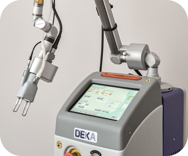 Лазерная система DEKA